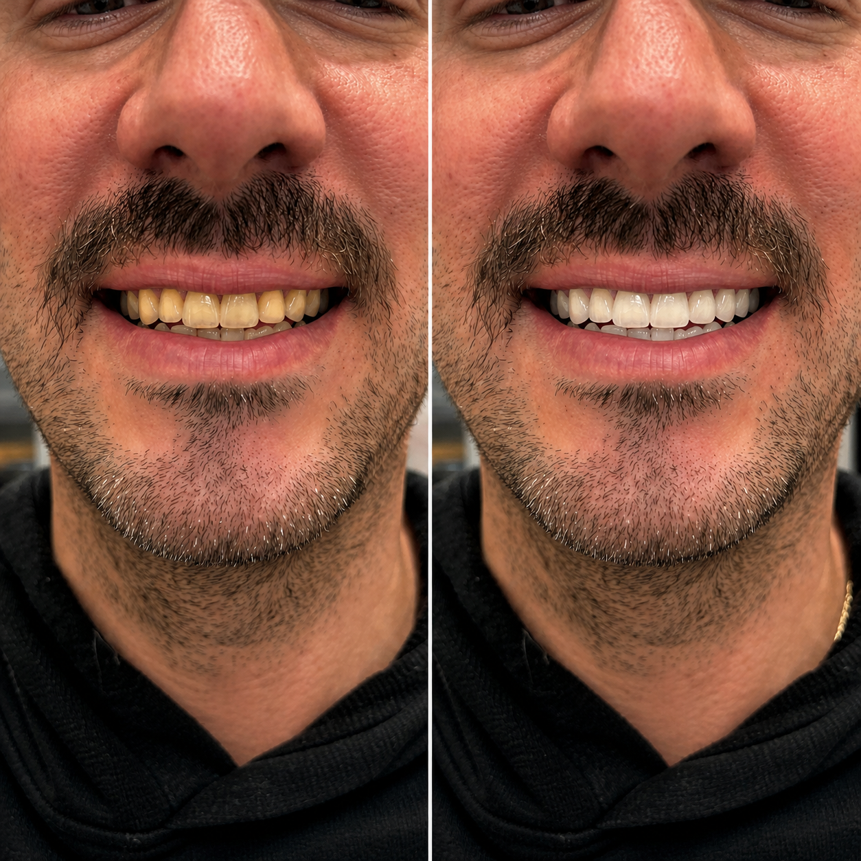 Jake before and after